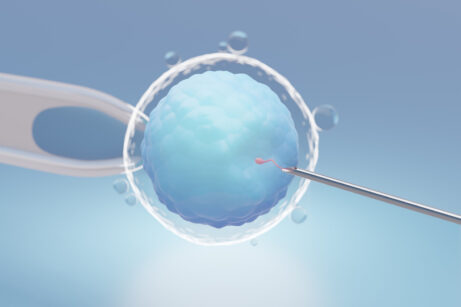 IVF